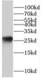 Dscr1 antibody, FNab07201, FineTest, Western Blot image 