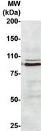 Heat Shock Transcription Factor 2 antibody, TA354394, Origene, Western Blot image 