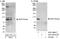 Eukaryotic Elongation Factor 2 Kinase antibody, A301-686A, Bethyl Labs, Immunoprecipitation image 