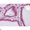Laminin Subunit Beta 1 antibody, LS-C814053, Lifespan Biosciences, Immunohistochemistry paraffin image 