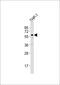 Zinc Finger Protein 92 antibody, M15417, Boster Biological Technology, Western Blot image 