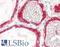 Thyroid Peroxidase antibody, LS-B10336, Lifespan Biosciences, Immunohistochemistry paraffin image 
