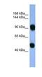 AP1B1 antibody, NBP1-68947, Novus Biologicals, Western Blot image 