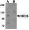 NLR Family Pyrin Domain Containing 9 antibody, A14119, Boster Biological Technology, Western Blot image 