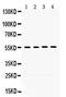 Matrix Metallopeptidase 8 antibody, PA5-79687, Invitrogen Antibodies, Western Blot image 