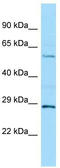 Multiple Inositol-Polyphosphate Phosphatase 1 antibody, TA331213, Origene, Western Blot image 