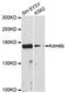 Lysine Demethylase 6B antibody, STJ114636, St John