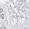 Chromosome 19 Open Reading Frame 12 antibody, HPA046930, Atlas Antibodies, Immunohistochemistry paraffin image 