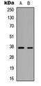 E3 ubiquitin-protein ligase MARCH5 antibody, abx121826, Abbexa, Western Blot image 