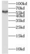 Prosaposin Like 1 (Gene/Pseudogene) antibody, FNab06845, FineTest, Western Blot image 