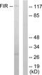 FERM, ARH/RhoGEF And Pleckstrin Domain Protein 2 antibody, LS-C118724, Lifespan Biosciences, Western Blot image 
