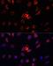 S100 Calcium Binding Protein A4 antibody, LS-C331598, Lifespan Biosciences, Immunofluorescence image 