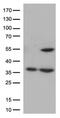 ACD antibody, NBP2-46216, Novus Biologicals, Western Blot image 