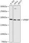 VPRBP antibody, 16-997, ProSci, Western Blot image 