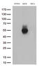 MHC Class I Polypeptide-Related Sequence B antibody, TA813499, Origene, Western Blot image 
