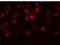 Regulator Of Microtubule Dynamics 2 antibody, A12543, Boster Biological Technology, Immunofluorescence image 