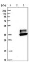 Carcinoembryonic Antigen Related Cell Adhesion Molecule 3 antibody, NBP1-85743, Novus Biologicals, Western Blot image 