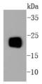 HCNP antibody, A01668-1, Boster Biological Technology, Western Blot image 