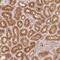 Coiled-Coil Domain Containing 102B antibody, PA5-61686, Invitrogen Antibodies, Immunohistochemistry paraffin image 