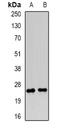 Dopamine Receptor D5 antibody, orb378038, Biorbyt, Western Blot image 
