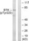 Bruton Tyrosine Kinase antibody, abx012418, Abbexa, Western Blot image 