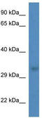 TRNA-Histidine Guanylyltransferase 1 Like antibody, TA342532, Origene, Western Blot image 