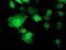 Translocase Of Outer Mitochondrial Membrane 34 antibody, TA503183, Origene, Immunofluorescence image 
