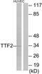 Forkhead box protein E1 antibody, GTX17612, GeneTex, Western Blot image 
