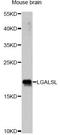 Galectin Like antibody, A14880, ABclonal Technology, Western Blot image 