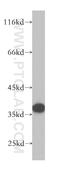 Mitochondrial Ribosomal Protein S28 antibody, 16457-1-AP, Proteintech Group, Western Blot image 