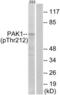 Alpha-PAK antibody, LS-C199399, Lifespan Biosciences, Western Blot image 