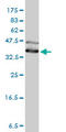 DnaJ Heat Shock Protein Family (Hsp40) Member A4 antibody, LS-B10984, Lifespan Biosciences, Western Blot image 