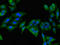 Mannosidase Alpha Class 2A Member 1 antibody, LS-C678551, Lifespan Biosciences, Immunofluorescence image 