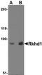 Mex-3 RNA Binding Family Member D antibody, orb75075, Biorbyt, Western Blot image 