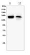 TEK Receptor Tyrosine Kinase antibody, A01274-2, Boster Biological Technology, Western Blot image 