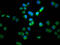 Protein phosphatase Slingshot homolog 1 antibody, LS-C681465, Lifespan Biosciences, Immunofluorescence image 