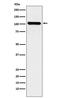 BRCA1 Interacting Protein C-Terminal Helicase 1 antibody, M01995, Boster Biological Technology, Western Blot image 
