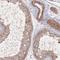 Laminin Subunit Alpha 1 antibody, NBP2-34181, Novus Biologicals, Immunohistochemistry frozen image 