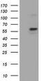Pyruvate Kinase L/R antibody, GTX83878, GeneTex, Western Blot image 