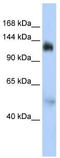 Nuclear Transcription Factor, X-Box Binding 1 antibody, TA330040, Origene, Western Blot image 