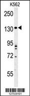Transmembrane Protein 132D antibody, 55-005, ProSci, Western Blot image 
