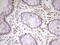 Myocyte Enhancer Factor 2D antibody, M01799, Boster Biological Technology, Immunohistochemistry paraffin image 