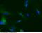 TEK Receptor Tyrosine Kinase antibody, 10700-R116, Sino Biological, Immunohistochemistry frozen image 