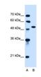 Activin A Receptor Type 1 antibody, orb330399, Biorbyt, Western Blot image 