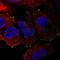 Small Integral Membrane Protein 11A antibody, HPA051321, Atlas Antibodies, Immunofluorescence image 