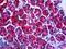 Phosphoglycerate Dehydrogenase antibody, LS-B5457, Lifespan Biosciences, Immunohistochemistry paraffin image 