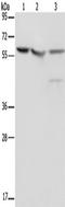 Nucleolar And Spindle Associated Protein 1 antibody, TA350247, Origene, Western Blot image 