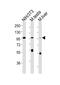 FER Tyrosine Kinase antibody, M01630, Boster Biological Technology, Western Blot image 