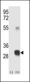 Ras Converting CAAX Endopeptidase 1 antibody, MBS9200807, MyBioSource, Western Blot image 