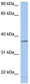 Lactate Dehydrogenase A Like 6B antibody, TA335425, Origene, Western Blot image 